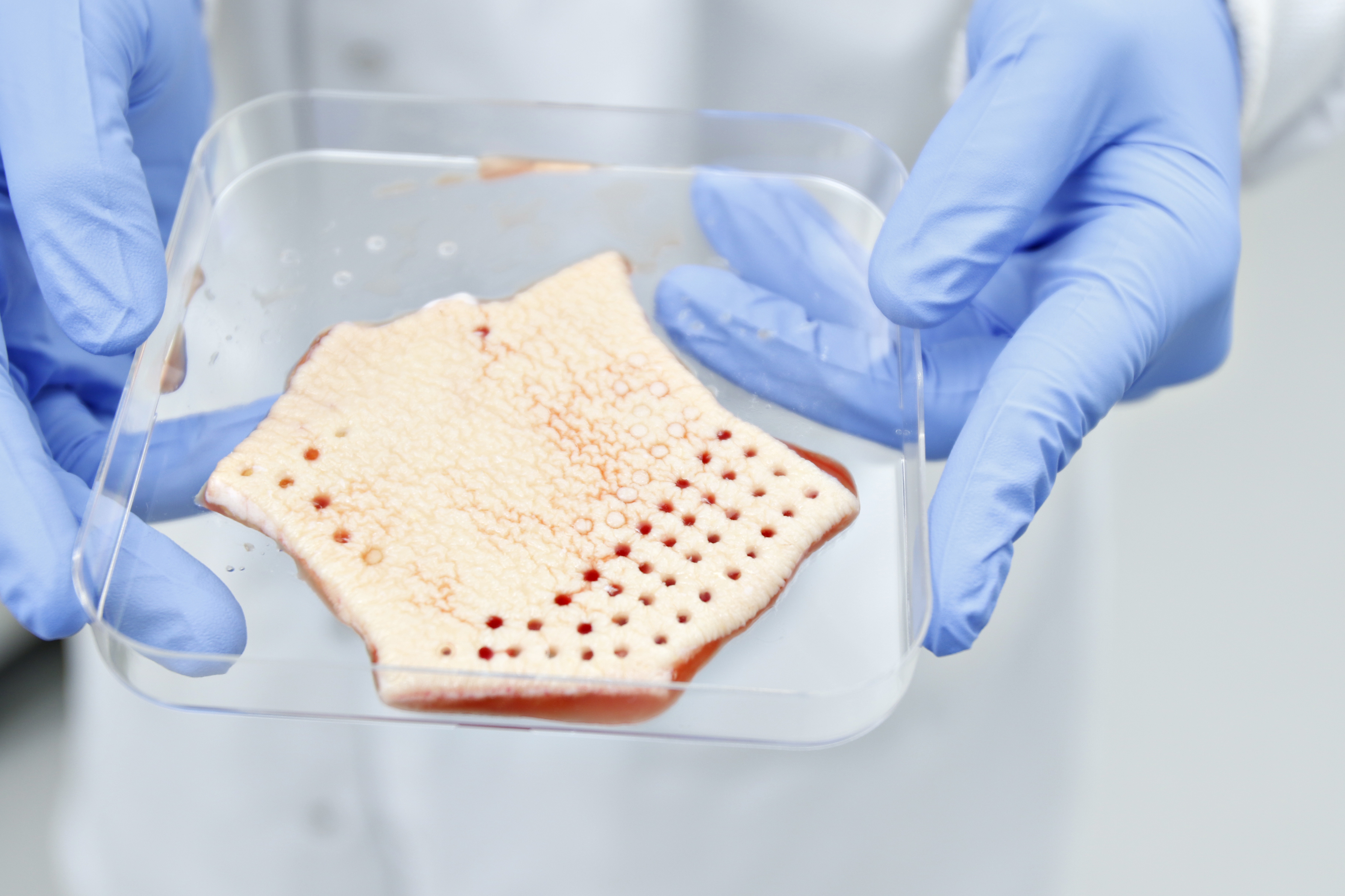 Експлант людської шкіри — ілюстрація до матеріалу про Outer Biosciences